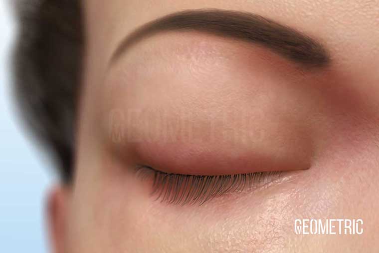 Dermatology, Skin Diseases