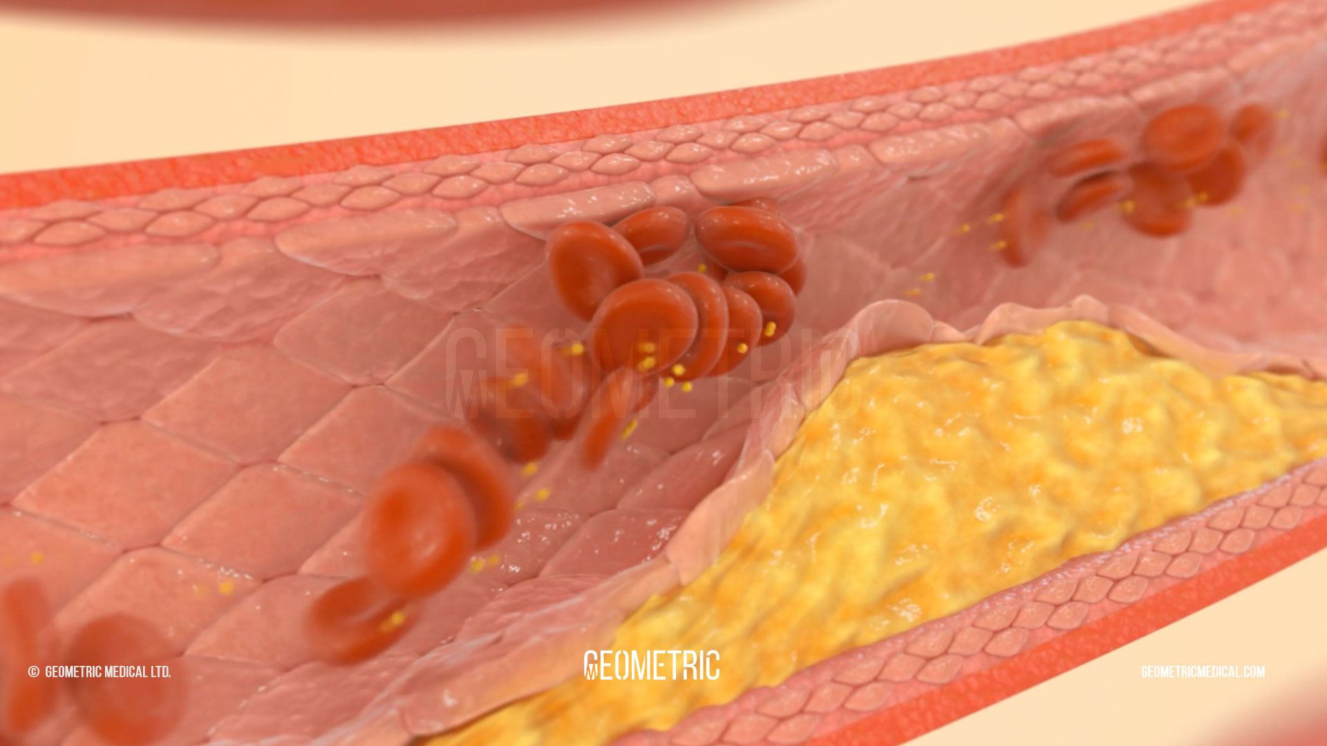 Facts about diabetes